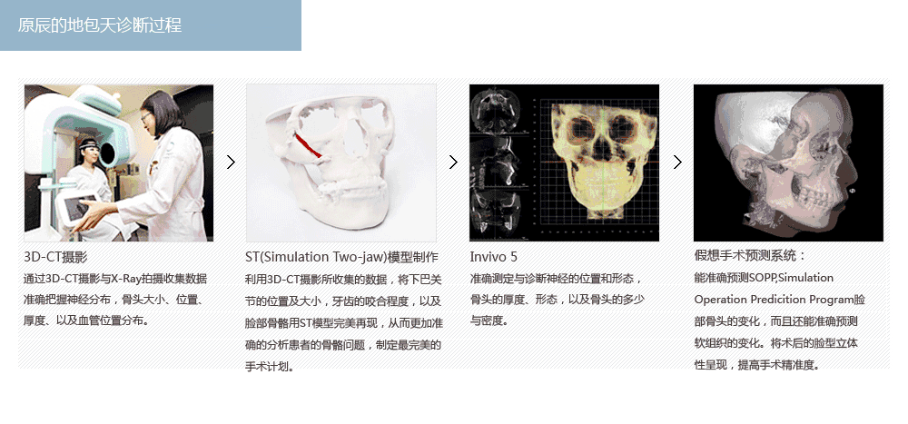 韩国地包天纠正手术多少钱