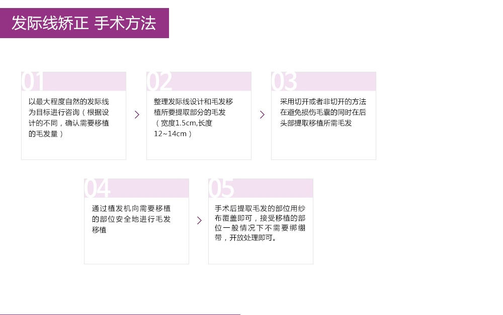 发际线矫正术(毛发移植)