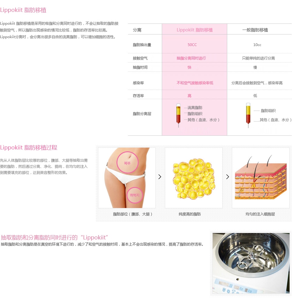 韩国自体脂肪移植手术价格