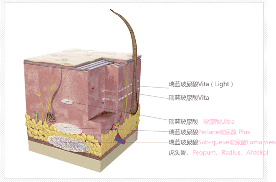 微整形大概要多少钱