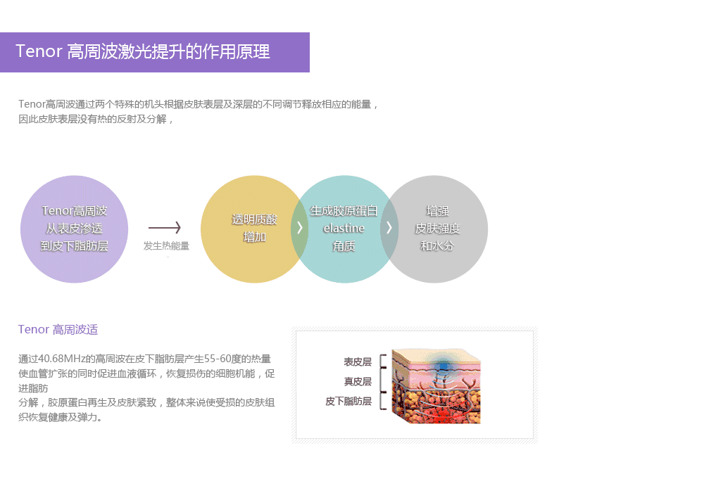 Tenor高周波价格