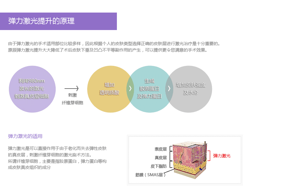 什么是激光提升