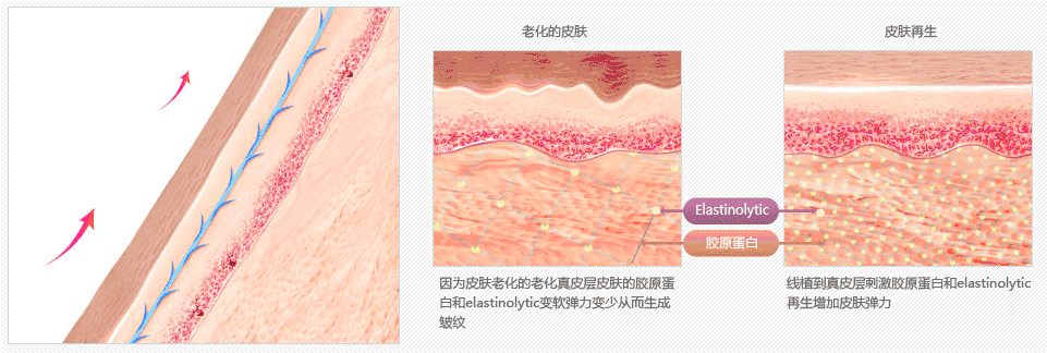 V提升优势