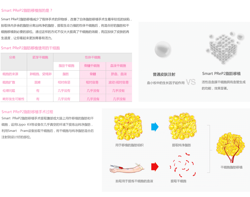 韩国自体脂肪移植手术