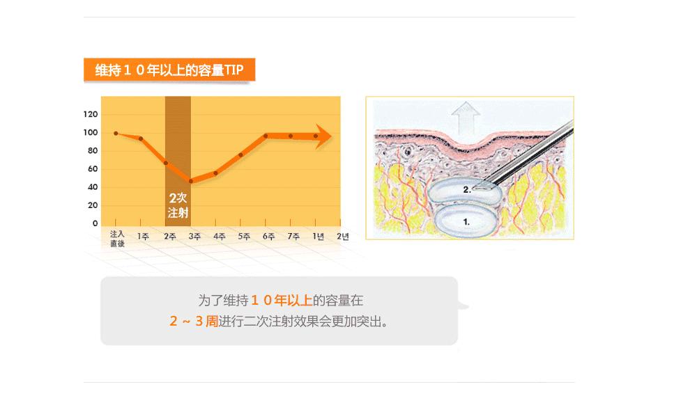 韩国专业的爱贝肤隆鼻医院