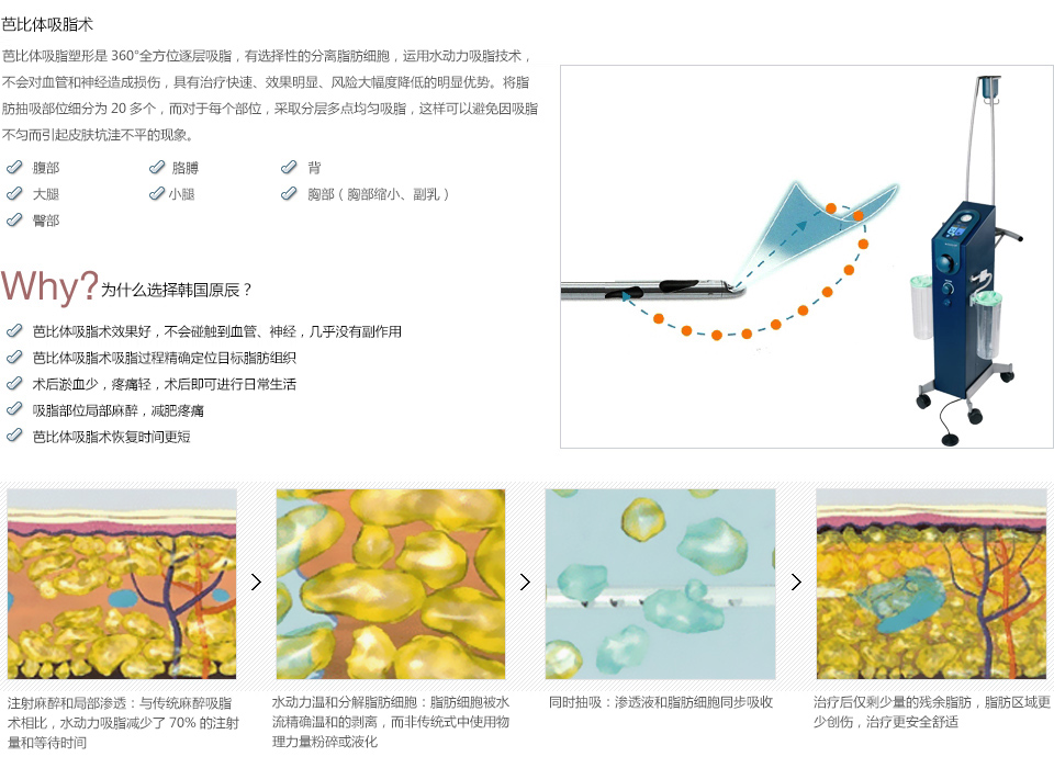 韩式吸脂减肥价格一览表